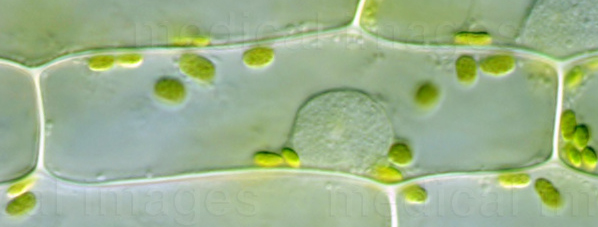 OneElodeaCellwNucleus